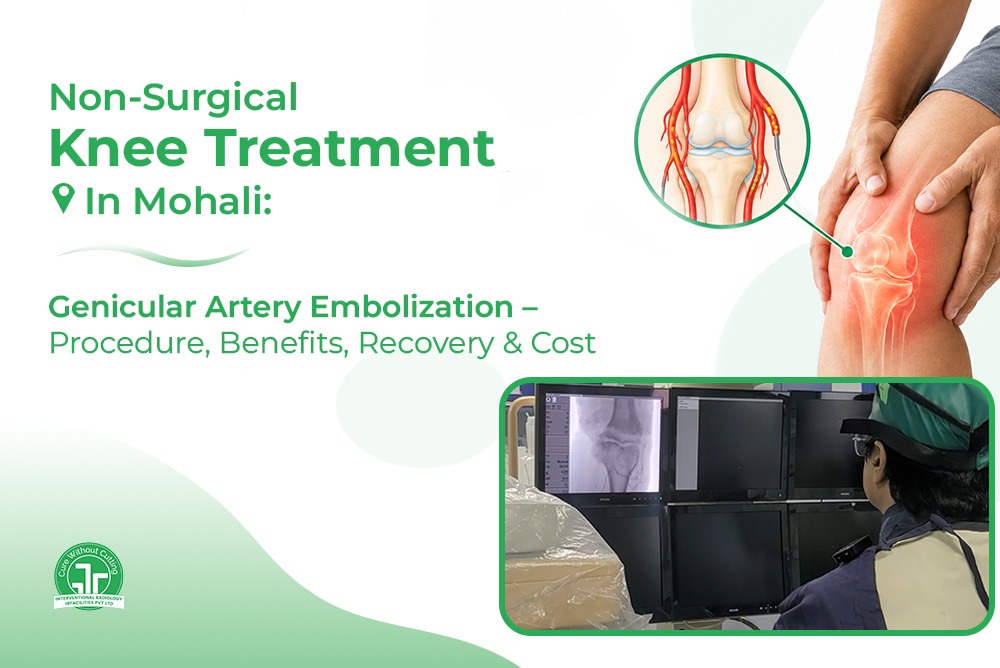 Non Surgical Knee Treatment In Mohali Genicular Artery Embolization Procedure Benefits Recovery and Cost